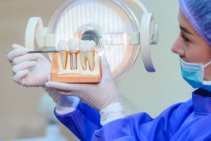 featured image for are same-day implants right for me