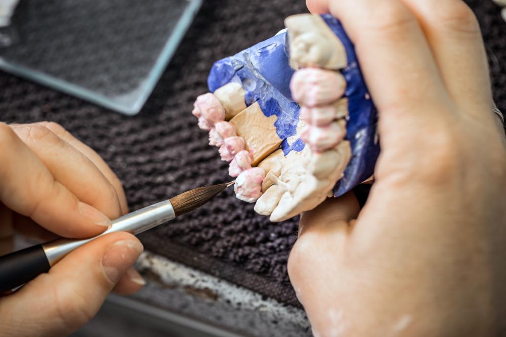 teeth models