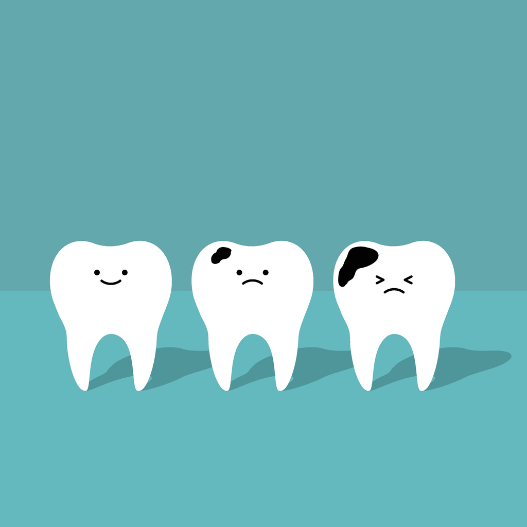 featured image for how to choose dental filling material