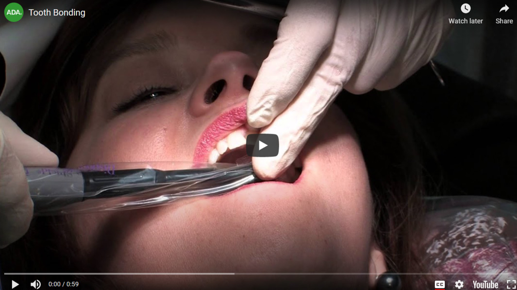 dental treatment