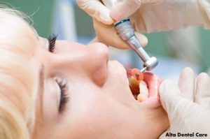 dentist drill
