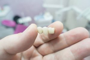 concept for what are the different types of dental bridges