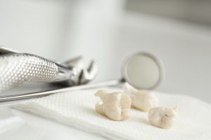 tooth models
