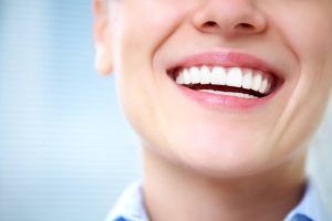 Woman before her veneers started staining